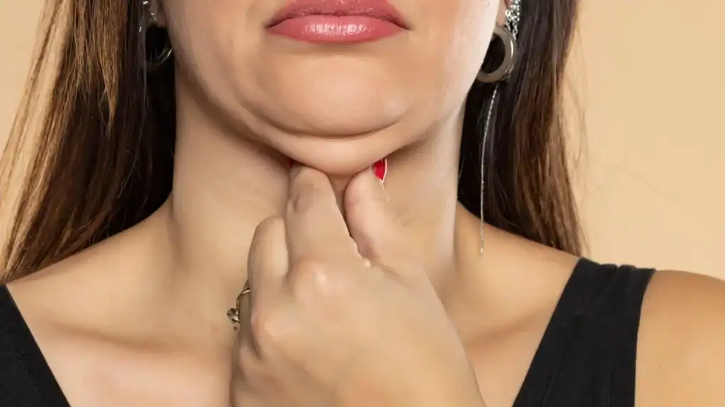 An image of a woman with double chin, sad, worried : Non Surgical Double Chin Removal Treatment in Irthlingborough, UK