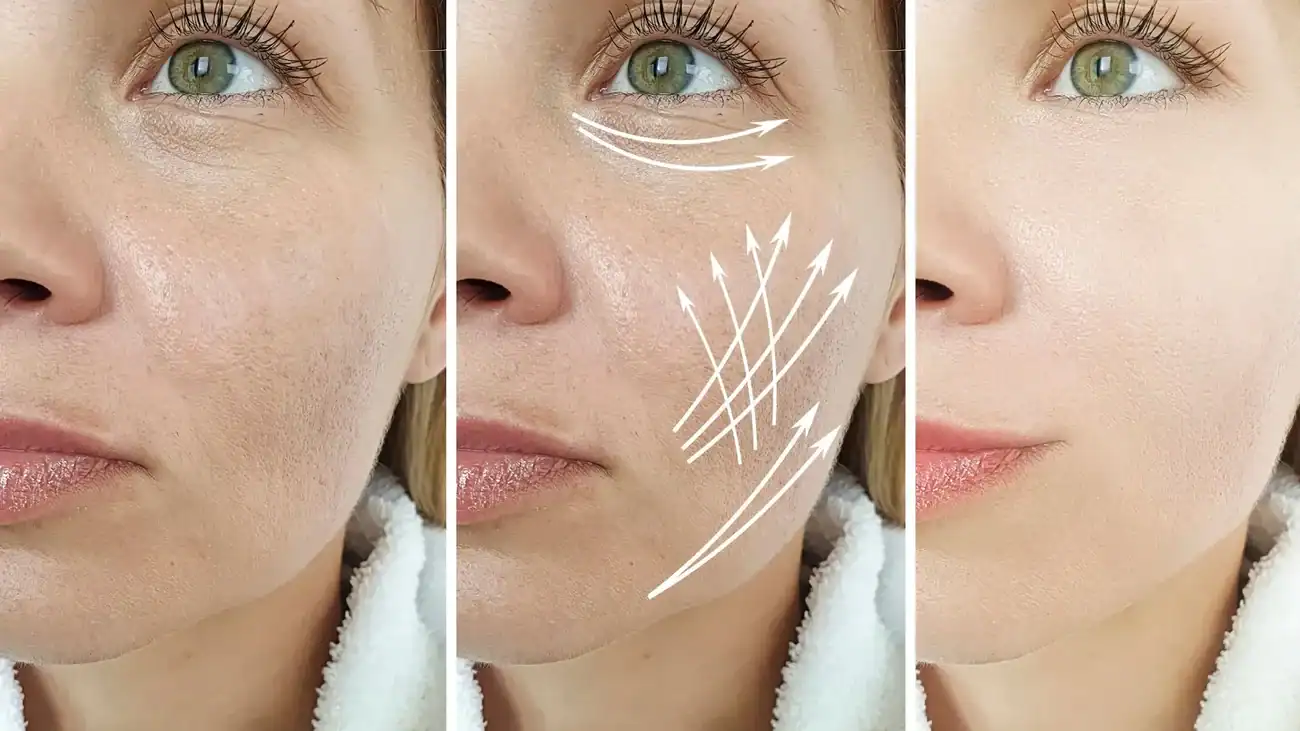 Can One Treatment Really Tackle More Than One Skin Concern Irthlingborough?