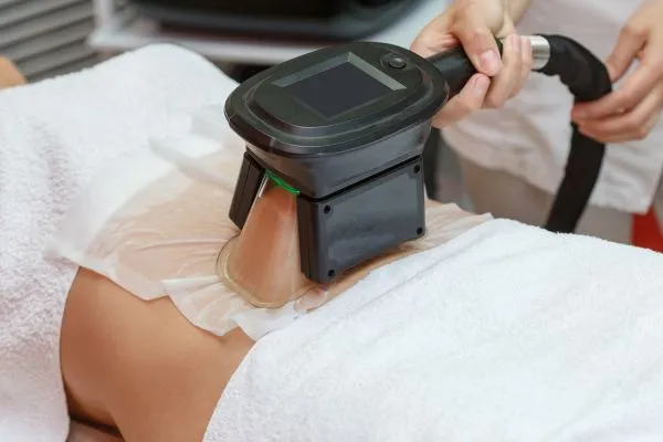 Image of person having fat freezing treatment to help weight gain Irthlingborough