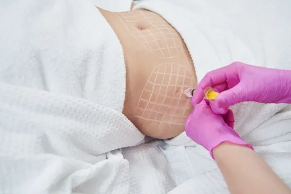 image of fat dissolving injections on love handles to help combat weight gain Irthlingborough