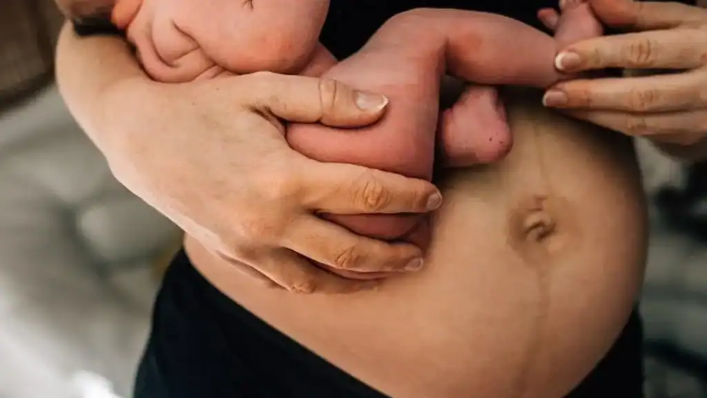 Why Is My Stomach Still Big After Pregnancy Irthlingborough?